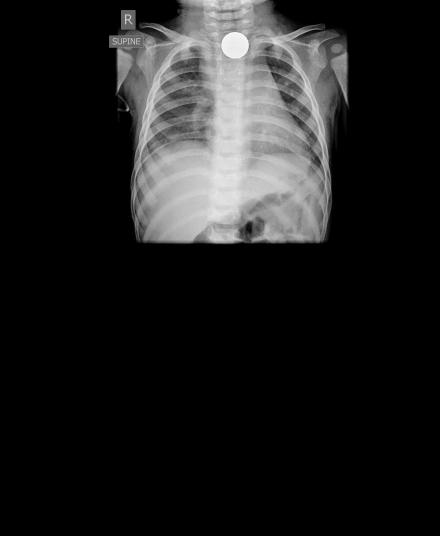 0513002198-20130115-CR-3-1